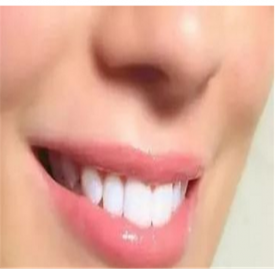 嘴唇干燥是什么原因 嘴唇干燥具体原因分析