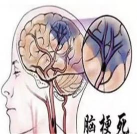 复方黄芪粥的作用与功效 常喝它让你血液畅通无阻