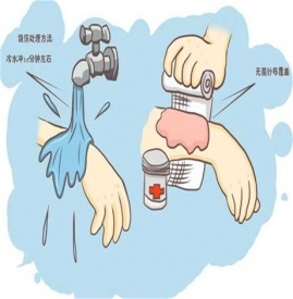 被开水烫伤怎么处理