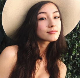 电波拉皮维持多长时间 电波拉皮能保持多久