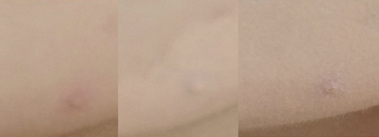 遮瑕怎么用具体步骤 痘印眼袋脓包统统搞定！