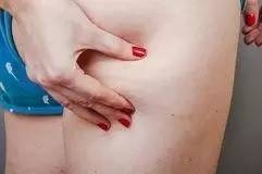 女生瘦小腿肌肉的方法 对号入座你的小腿是肌肉腿吗