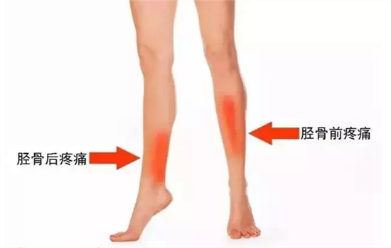 跳绳后小腿酸痛怎么办 三个简单办法助小腿复原