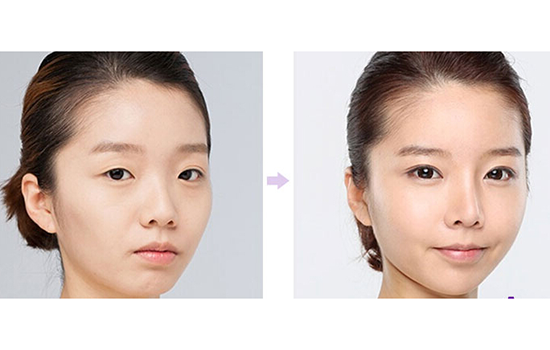 美瞳线适合哪些人 素颜就想有美美哒眼睛的妹纸