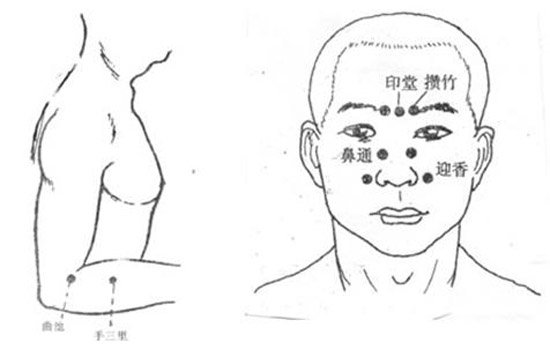 花粉过敏性鼻炎怎么办 最重要的就是避开过敏源