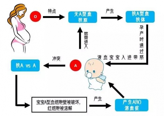 abo溶血症是什么意思 为您详解溶血症的相关问题