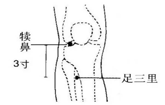 坐月子上火怎么办 对症下药+生活调理