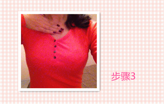 假体隆胸多久能恢复自然 快速恢复自然要这个护理