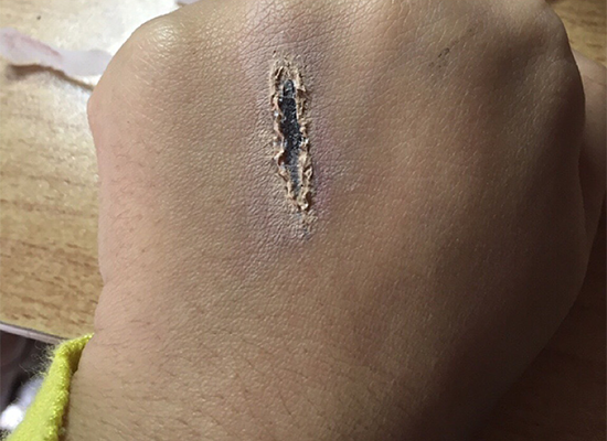 画小伤口详细教程 万圣节必学伤口特效妆