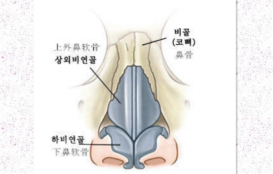 硅胶隆鼻取出多久消肿 隆鼻失败修复术后消肿至少需14天