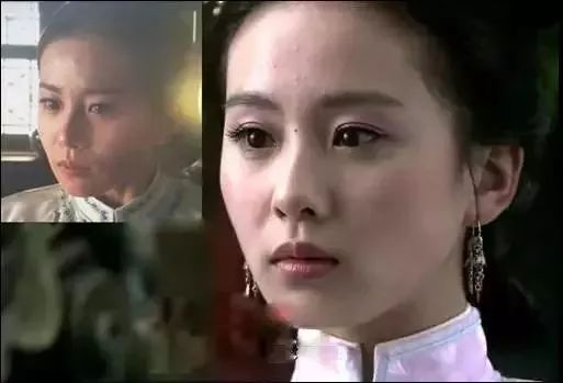 脸上的闭口怎么处理 注意这几点还你天然好肌肤