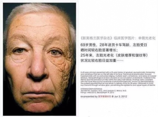 皮肤保养的基本步骤 学好皮肤管理变女神