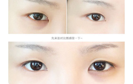 遮黑眼圈用什么颜色的口红 轻松摆脱熊猫眼