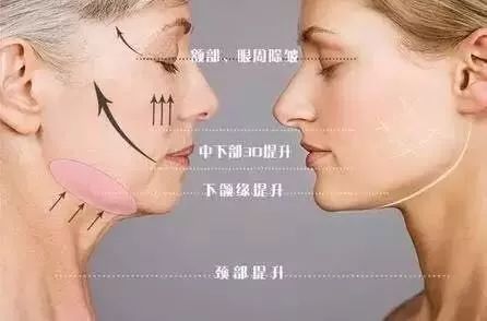 怎么变V字脸  变美变年轻变V脸的秘诀