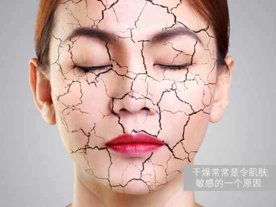 皮肤敏感怎么保养 敏感肌肤护理方法
