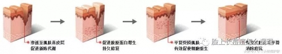 痘印形成的原因 痘印产生原因及淡化痘印的方法