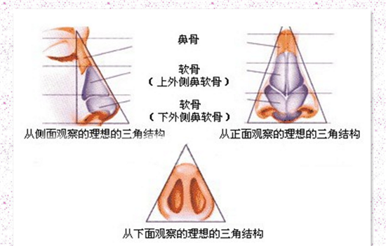 鼻子修复是怎么做的 多图解析隆鼻取出全部过程