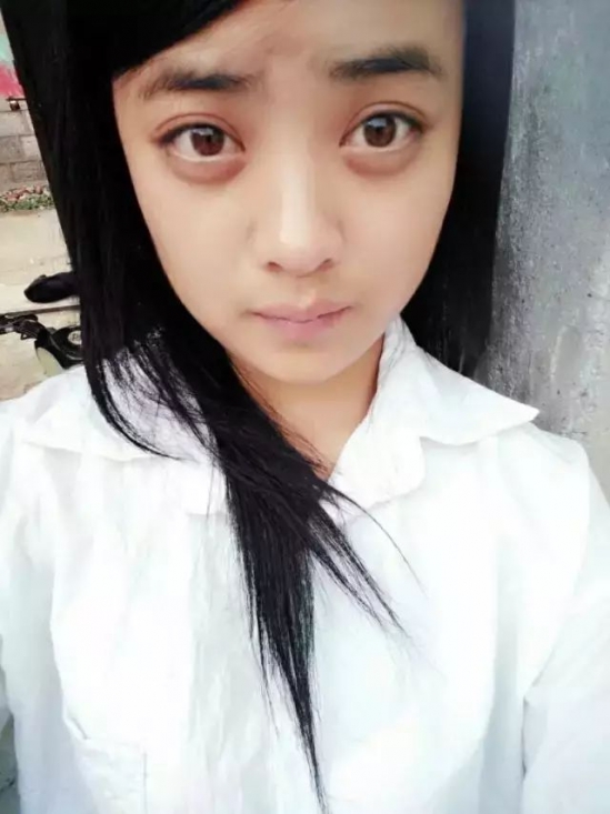 眼袋的危害   眼袋不消还谈什么美丽不美丽的