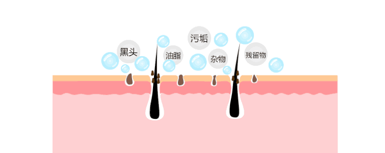 去黑头的最好方法  让颜值天敌黑头消失无踪的利器