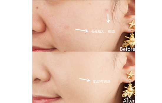 兰蔻菁纯气垫怎么样 全能底妆lancome菁纯气垫