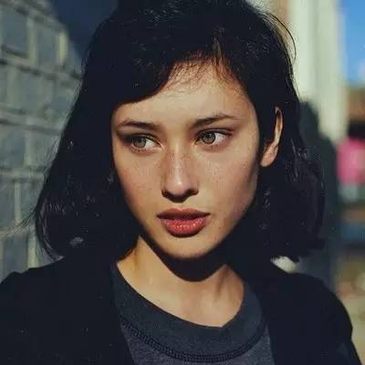 各种斑的形成原因 祛斑难那是你不了解长斑的原因