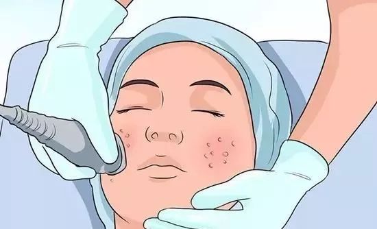 鼻子上的黑头怎么去掉 这是消灭“草莓鼻”最有效的方法！