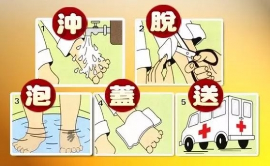 小孩烫伤处理方法 烫伤后这样做小心造成二次伤害