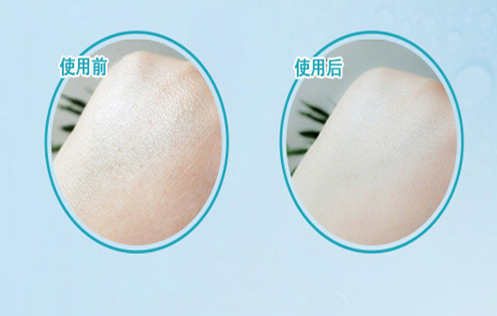 欧莱雅天才水好用吗 欧莱雅天才水测评