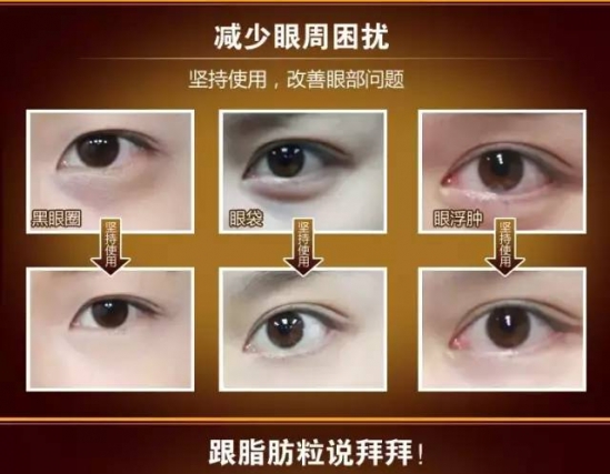 眼部保养的方法 眼部护理的正确步骤
