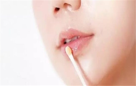 澳洲木瓜膏能治冻疮吗 “万能膏”并不能治疗冻疮