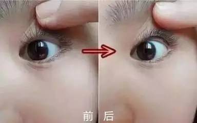 美瞳线为什么会脱色 这两种情况最为常见