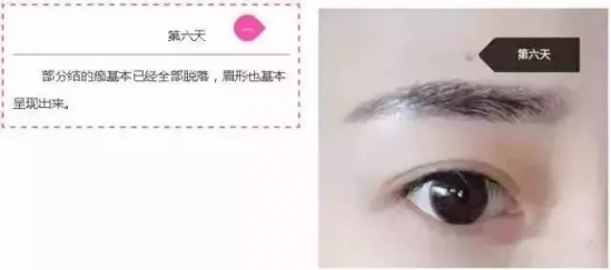 纹眉七天的变化 小仙女快看过来吧