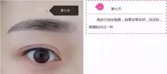 纹眉七天的变化 小仙女快看过来吧