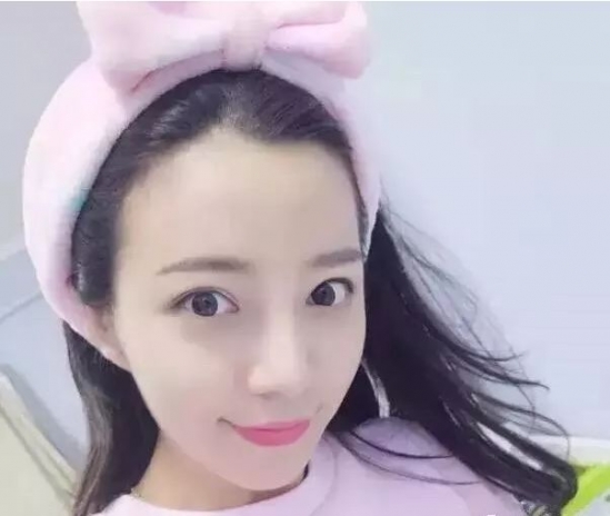 纹眉七天的变化 小仙女快看过来吧