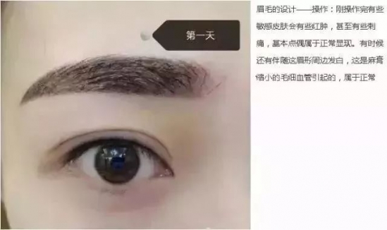 纹眉七天的变化 小仙女快看过来吧