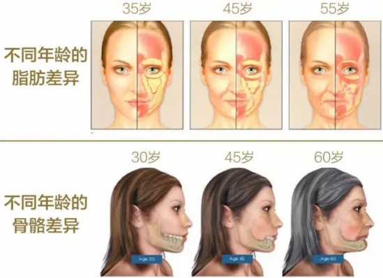 怎样抗衰老 抗衰不做日子怎么过