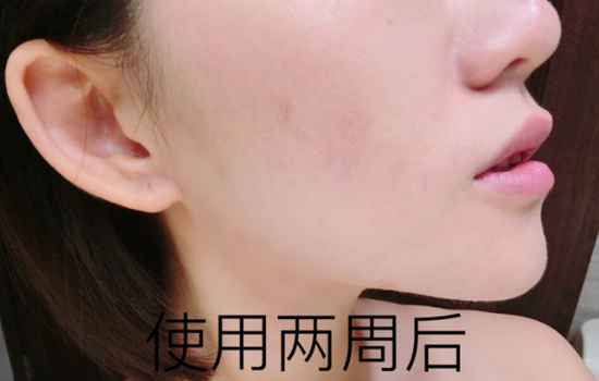 兰蔻小黑瓶保质期多久 教你从生产批号辨别生产日期