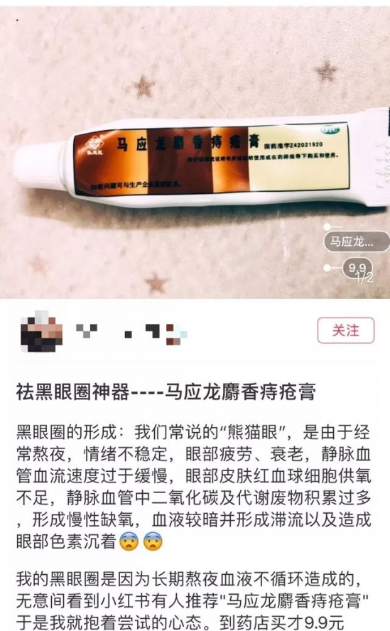 痔疮膏能治黑眼圈吗 痔疮膏可以去黑眼圈吗