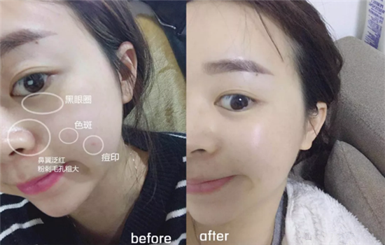 兰蔻小黑瓶面膜要洗吗 兰蔻面膜用后洗脸不