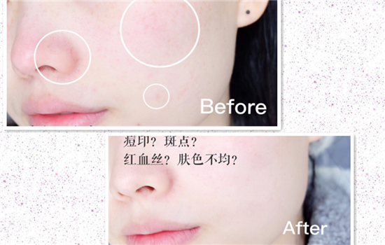 兰蔻小黑瓶去角质吗