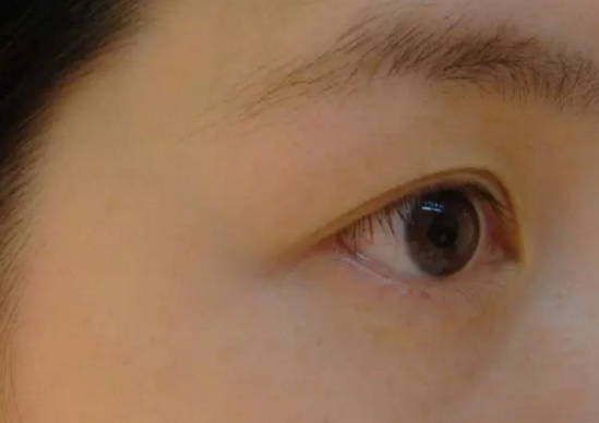 雅诗兰黛和sk2眼霜哪个好