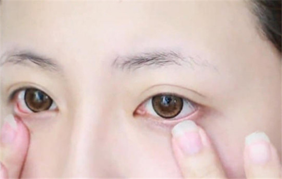 眼霜的正确使用方法是什么 眼霜怎么用