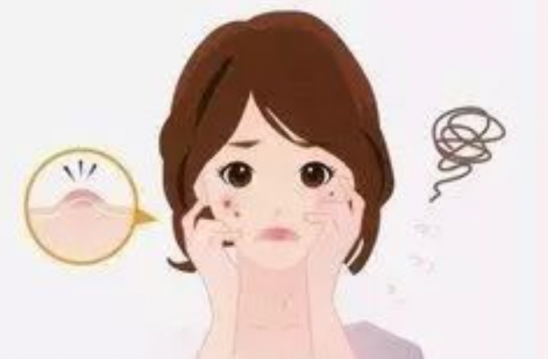 怎样去痘痘和痘印 脸上痘痘痘印怎样去除
