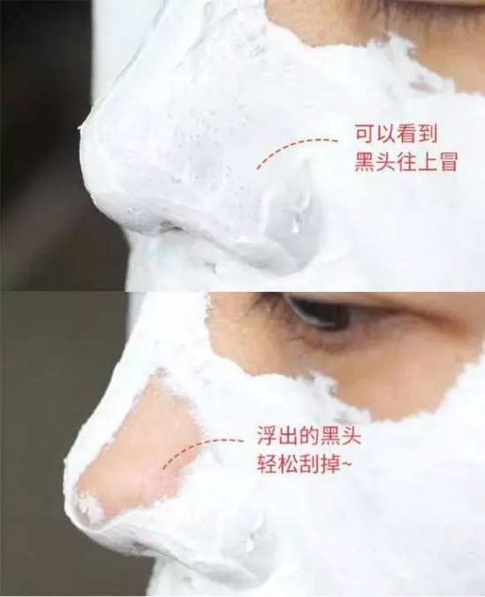 屁屁霜怎么用