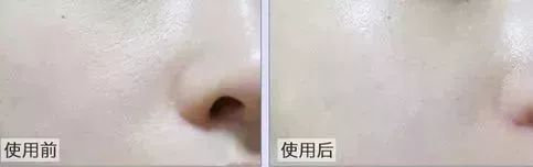 夏季水乳该怎么选