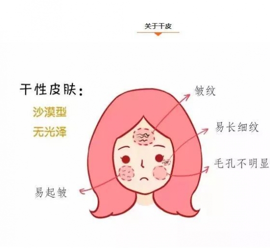什么是干性皮肤 干性皮肤是什么样的