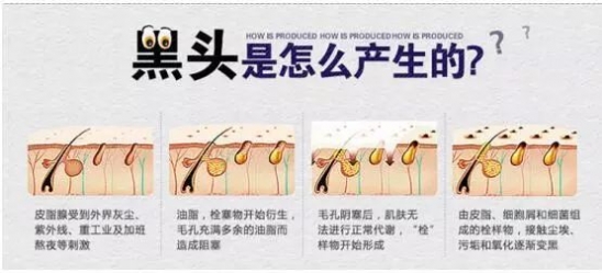 去黑头最有效的产品