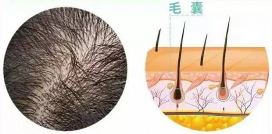 白发变黑妙招 白发变黑用这4招很实用