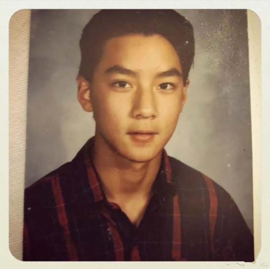 怎么看自己是否脱发 怎么判断自己是不是脱发