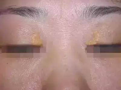 心脏不好有什么表现